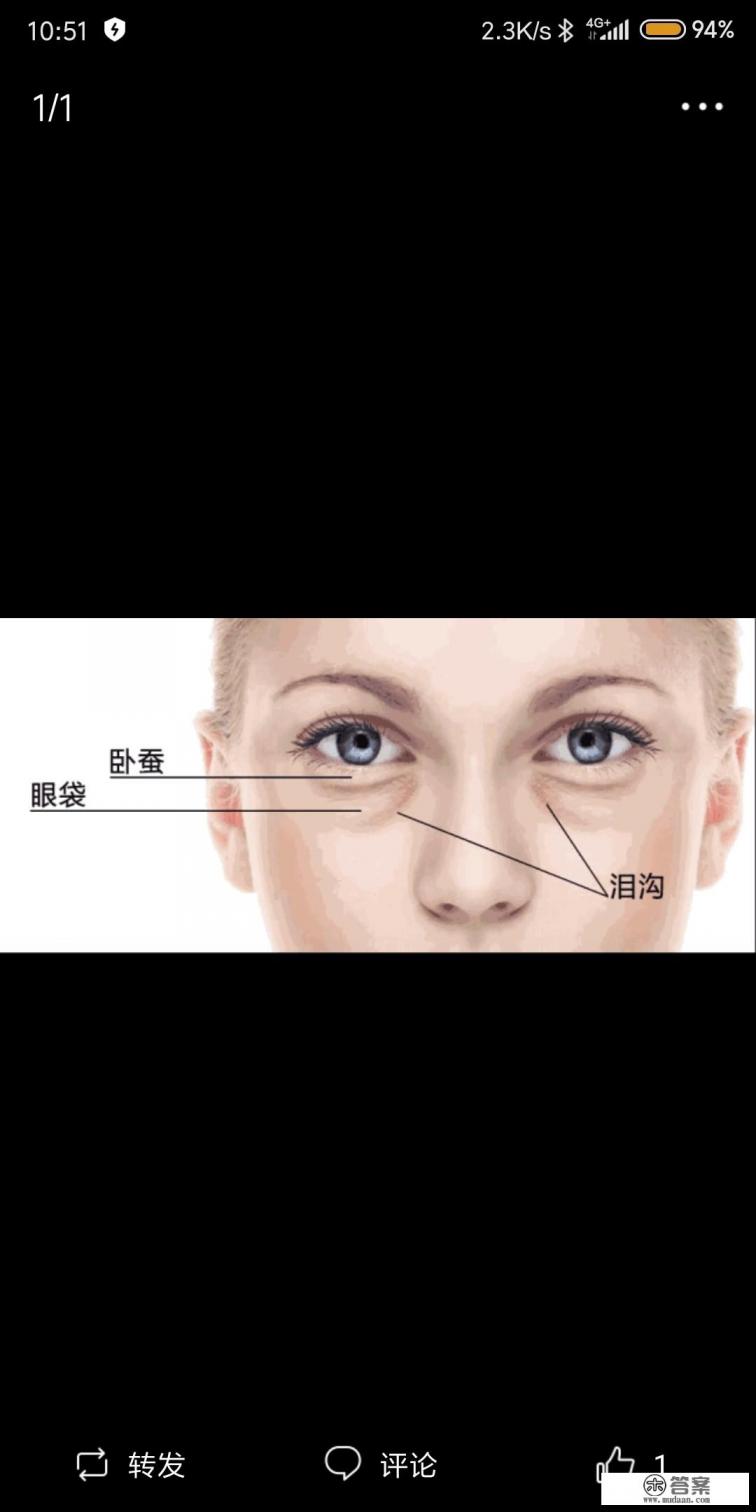 不熬夜泪沟会恢复吗？