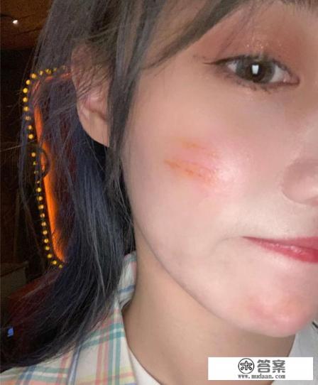 IG选手游玩鬼屋出意外，小钰面部破相，Rookie心碎，乐言惨遭吐槽，你怎么看？