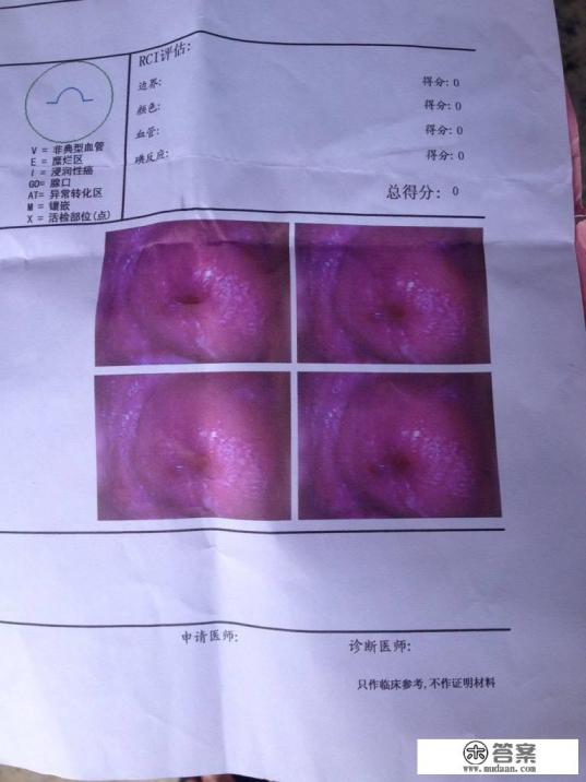 得过宫颈糜烂，经治疗痊愈后是否影响怀孕？