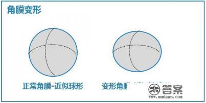 近视100度左右,是一直带着眼镜好,还是光学习的时候带着好?