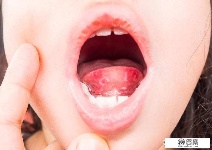 刷牙刷舌苔好吗?