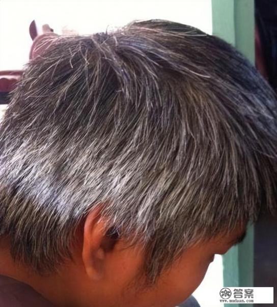 熬夜和精神紧张,长出来的白头发还能变黑回来吗?