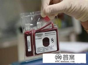 如何储存脐带血?