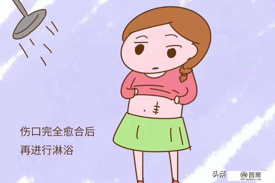 剖腹产多久可以洗头洗澡？
