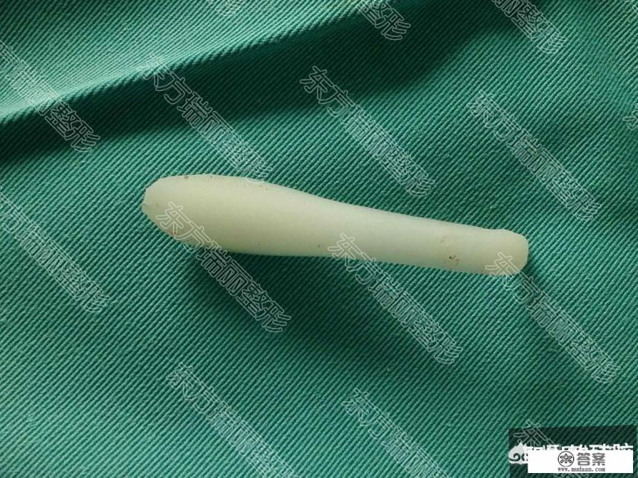 硅胶假体可以一直放在鼻子里吗？为什么？