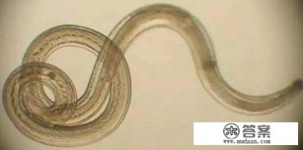 假如感染血吸虫病后会有哪些症状？该怎么治疗？