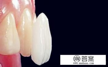 3dwhite牙贴怎么用？