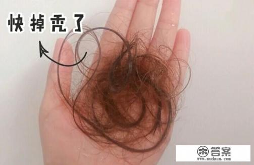 头皮有油脂粒,用什么洗发水好? 头皮有油脂粒,用什么洗发水好?