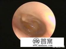 654-2是什么药?我们这有卖的吗? 654-2是什么药?我们这有卖的吗?