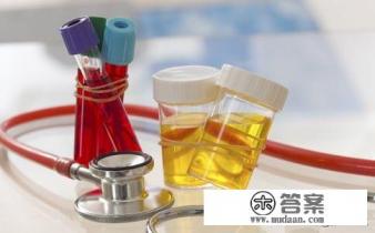 大量蛋白尿能治好吗? 大量蛋白尿能治好吗?