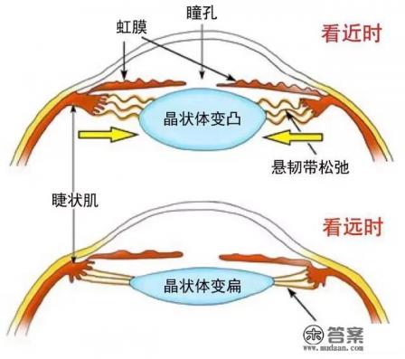 眼睛近视，看书与看手机哪个更伤眼？