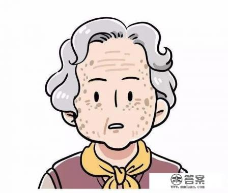 怎样快速去除老年斑？