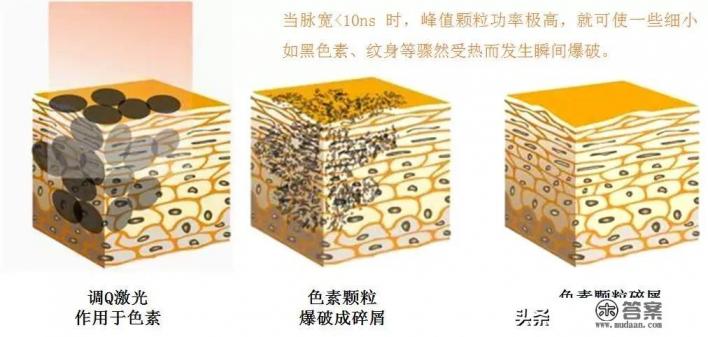 怎样快速去除老年斑？