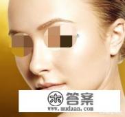 歪鼻矫正手术安全性怎么样? 歪鼻矫正手术安全性怎么样?