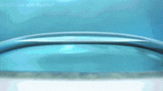 近视眼手术有哪几种？