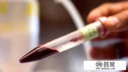 人体的血液是属于什么组织？