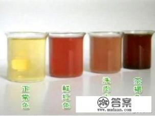 小儿肾炎有什么症状？