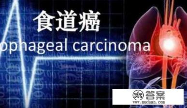 食道癌是什么？