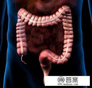 肠癌会传染吗？