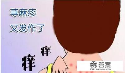 慢性荨麻疹怎么治疗？