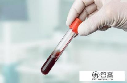 内风湿因子<20是什么意思？