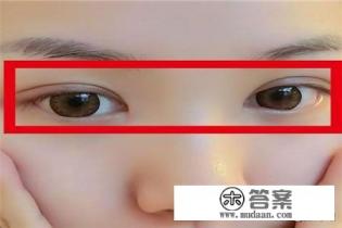 开双眼皮手术多少钱