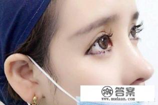 开双眼皮手术多少钱