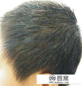 小孩长白发的原因可以从遗传和环境两个方面进行分析。一方面,遗传因素可能与父母双方的白发遗传有关;另一方面,环境因素如健康的生活习惯、充足睡眠和良好的饮食习惯可能影响皮肤健康,从而导致长白发。