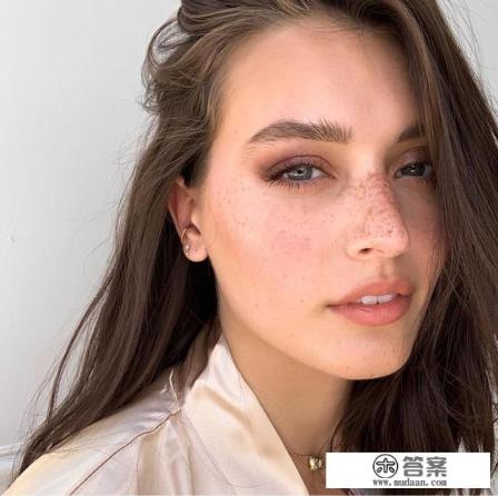 激光祛斑一次需要多少钱