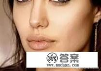 激光祛斑手术后要如何护理 激光祛斑手术后要如何护理