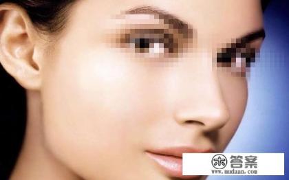 激光祛斑一次多少钱