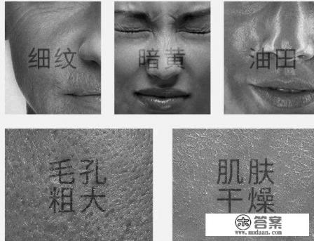 爽肤水到底是干什么用的 爽肤水到底是干什么用的