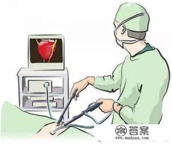 腹腔镜手术疼吗