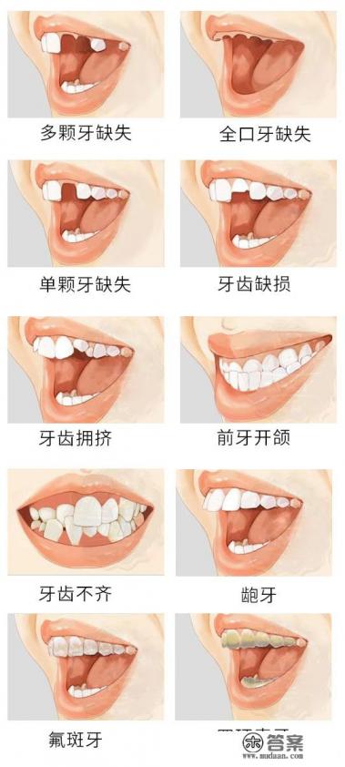什么叫牙、什么叫齿。它们又有什么区别!谢谢了,大神帮忙啊 什么叫牙、什么叫齿。它们又有什么区别!谢谢了,大神帮忙啊