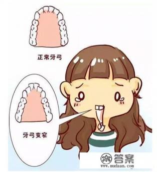 龅牙怎么矫正 龅牙怎么矫正